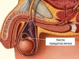 Лёгкая боль в придатке яичка от онанизма?