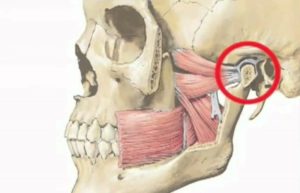 Болит сустав соединения верхней с нижней челюстью