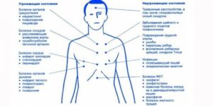 Периодические приступы боли в области солнечного сплетения
