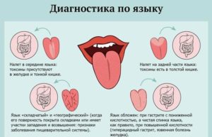 Боль в животе белый налет на язык
