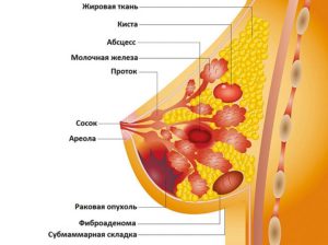 Комочки в груди