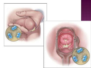 Маструбация во время лечения хламидиоза