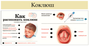 Коклюшь и тд