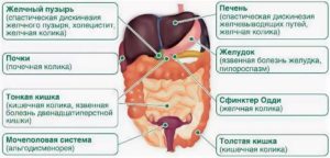 Колики в животе, вздутие