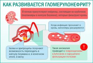 Болят почки температура 37