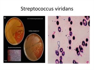 Массивный рост стрептококка вириданс
