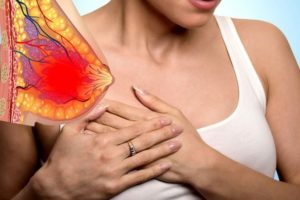 Мастопатия, сильная боль в груди