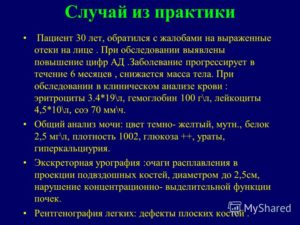 Исследования при подозрении на миеломную болезнь