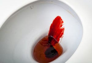 Кровь после туалета