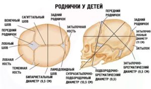 Большой родничок в 1 год и 2 месяца