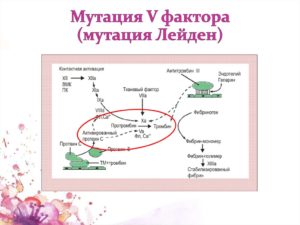 Планирование беременности с мутацией Лейдена гетерозигота