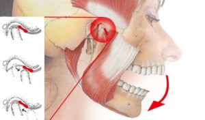 Боль в месте соединения челюстей