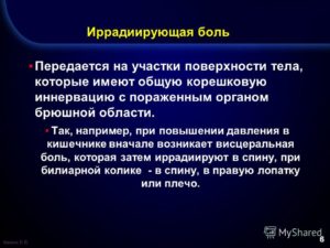 Боль в желудке с иррадиацией