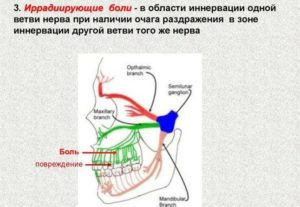 Иррадиация боли