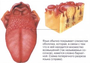 Болит горло и бугорки на языке