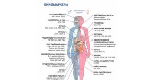 Кальцитонин онкомаркер