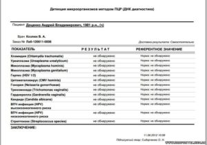 Когда можно сдать пцр после приёма антибиотиков