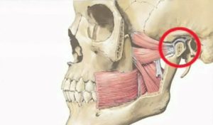 Хруст в челюсти после удара