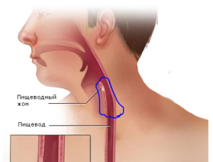 Комок под кадыком, ощущаю его при глотании