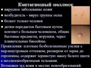 Контагиозный моллюск, плохие анализы крови и мочи