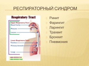 Ларингит или бронхит?