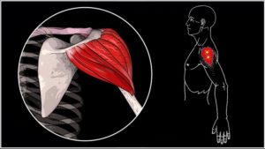 Боль в плече под передней дельтой