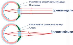 Истинное зрение при спазме