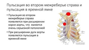 Ком и боль в яремной вырезке