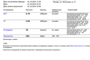 ЛГ 56.70 мМЕд/мл это критично!