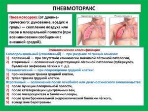 Боли после пневмоторакса