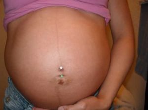 Пирсинг пупка во время беременности
