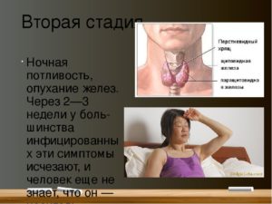 Боль в области щитовидной железы