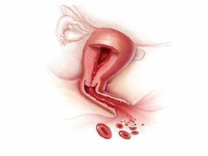 Кровь во время полового акта