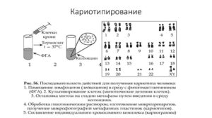 Кариотип расшифровка