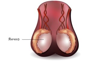 Болит правое яичко