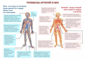 Боли в области шва 21 летней давности