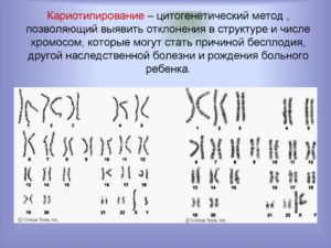 Кариотип при планировании беременности