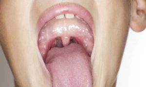Боль в горле и под языком после сна