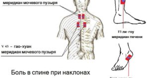 Болит поясница и больно наклонять голову