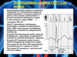 Как прочитать кардиограмму ЭКГ