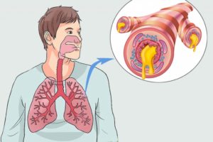 Лёгкие, бронхи, горло, нос чистые, а температура не спадает