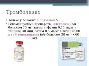 Кальпротектин больше 1000 мг/кг