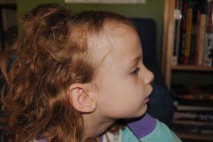 Ломкость волос у ребенка