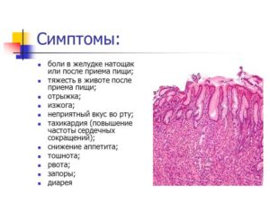 Болит желудок от воды на тощак