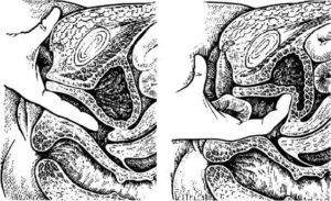 Боль при введении полового члена во влагалище и при мочеиспускании