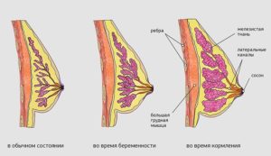 Болит и набухла грудь