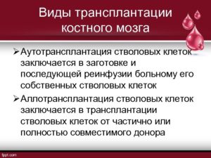 Пересадка костного мозга при лимфоме