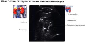 Левая почка меньше правой. Меня врач пугает