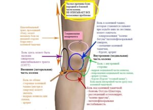 Боль со внутренней стороны колена
