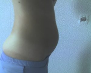Мажущие короткие месячные, вздутие низа живота, симптомы беременности